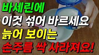 바세린에 이것 섞어 바르면 늙어 보이는 손 주름 사라지고 탱탱해져요! 손 주름 없애는 법 입가 주름 없애는 방법 바세린 효능!