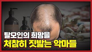 탈모 제품들은 탈모를 더 악화시키고 있다. (효과없음)