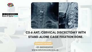 Dr. Vivek Agrawal  - Best Spine surgeon In Nagpur. Cervical spine surgery in nagpur.