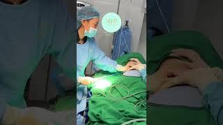 Abdominal Etching with Argo Plasma Procedure