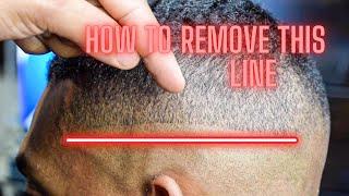 EASIEST WAY TO REMOVE A BALD GUIDELINE!