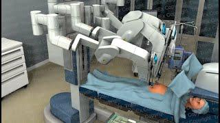 How the Da Vinci Surgical System Works - Laparoscopic Hysterectomy