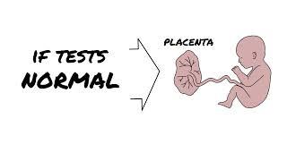 Neonate (newborn) Strokes | AboutKidsHealth at The Hospital for Sick Children