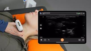 Ultrasound Image Gain