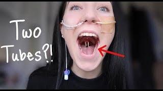  Two Tubes? How To: Place an NG Tube! | Amy Lee Fisher 