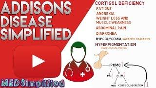 Addisons Disease Made Simple - Primary Adrenal Faliure