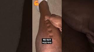 몸이 찰흙처럼 변하는 병