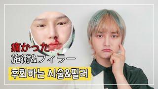 가장 아팠던, 후회하는 시술&필러ㅣ비글S2 BeagleS2 