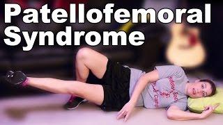 Patellofemoral Syndrome Exercises & Stretches - Ask Doctor Jo