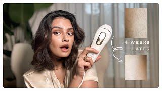 IPL Hair Removal At Home with Braun! What I think 1.5 years later!