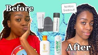 Dermalogica Nighttime Skincare Routine for Oily / Acne Prone Skin