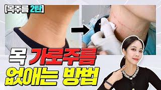 [목주름 2탄] 목 가로주름 없애는 셀프시술 공개 #목주름 #주름개선 #주름관리