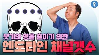 붓기와 멍을 줄이기 위한 엔도타인 채널 갯수