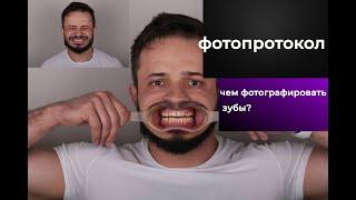 ЧЕМ ФОТОГРАФИРОВАТЬ ЗУБЫ