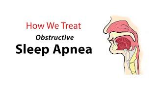 How We Treat Obstructive Sleep Apnea