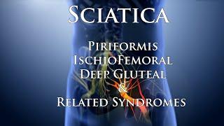 Sciatica & Related Syndromes-- Treatments & Interventions for Sciatic Nerve Release