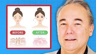 How to LOSE Your Wrinkles (Natural Remedy) | Dr. William Davis