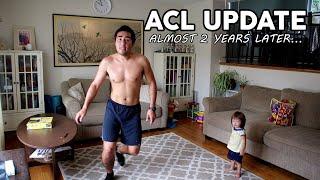 ACL Surgery Recovery - Year 2 - Recovery Level, Sports, Exercise Routine, Tips