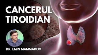 CE TREBUIE SĂ ȘTII DESPRE CANCERUL TIROIDIAN | Dr. Emin Mammadov, medic specialist endocrinologie