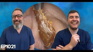 STICKY EAR WAX REMOVALS - EP1021