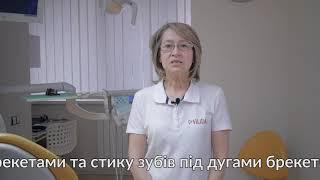 Правила чищення зубів під час носіння брекетів