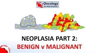 2. Neoplasia part 2: Differences between benign and malignant neoplasms