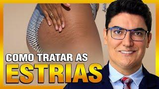 Como tratar as Estrias?