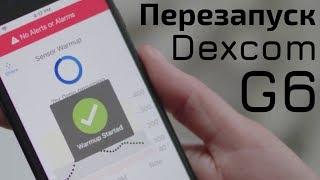 Перезапуск сенсора Dexcom G6! (80-я серия)