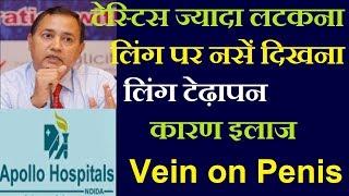 Testis Ka Latakna | Loose Scrotum | Prominent Veins on Penis  | Angulation Penis | लिंग का टेढ़ापन