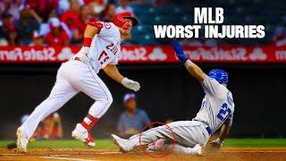 MLB Worst Injuries IN Baseball