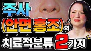 안면홍조 시리즈2편주사 피부염 치료의 핵심은 2가지 치료적 분류법입니다.원인별 분류를 해야 원인 치료가 가능합니다. 로사세아 안면홍조