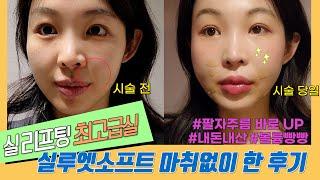 실루엣플리프팅(실리프팅) 팔자,입가주름 즉각효과 본 당일후기ㅣ시술과정ㅣ실루엣소프트ㅣQ&A