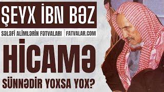 Hicamə sünnədir yoxsa yox? Şeyx İbn Bəz I fatvalar.com