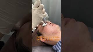 #울산피부과#울산남구피부과#어븀프락셀#모공레이저#여드름흉터레이저#모공흉터레이저#울산흉터치료#울산모공치료#울산쥬베룩#울산미라젯#울산큐어젯#미라젯#큐어젯#울산피부레이저#울산피코토닝
