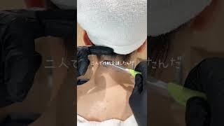 うたさんエピソード#美容 #うなじ脱毛 #ネープデザイン #dermaplaning