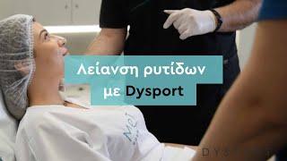 Λείανση ρυτίδων με Dysport