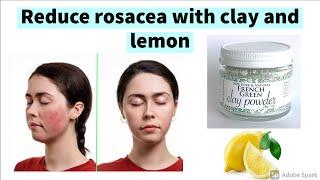 Reduce rosacea with clay and lemon - Attenuate, more or less strongly, the marks of rosacea