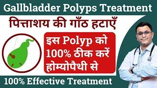 Gallbladder polyps ka Homeopathic ilaj Homeopathic medicine for gallbladder polyps #RxHpathy