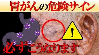 【医師監修】放置すると後悔する「胃がんが隠れている超意外な症状7選」