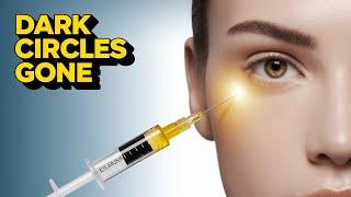 "Erase Dark Circles & Hollows  for GOOD" #DarkCircles #UnderEyeHollows #NoMoreWrinkle