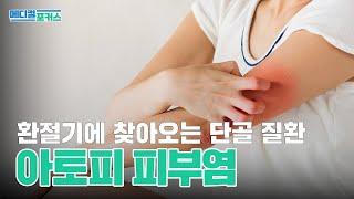 건조한 날씨가 심해지는 요즘, 아토피 이렇게 관리해보자! | 아토피 피부염 | 메디컬포커스