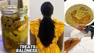 This Potent Hair Tea Will Regrow Your Hairline | Hair Loss Solution