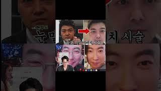 Ep8_1_리프팅공부 / 대구눈밑지방재배치 효과 없는데 왜 하시나요1탄 다크써클 ▶︎ #대구눈밑지방재배치 #눈밑지 #대구성형외과 