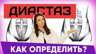 Диастaз: как определить. Диастaз что это такое. Диастаз после родов | Евгения Кузнецова тренер | 12+