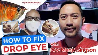 Drop eye surgery