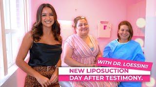 Liposuction testimony | Dr. Loessin| CG Cosmetic Surgery