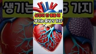심장이 안 좋을 때 생기는 증상 다섯 가지 #면역 #이슈 #건강 #영양식 #올바른정보