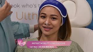 INSTANT NOSE LIFT,  Nose Specialist - Dr. Contessa Salvador Alapag