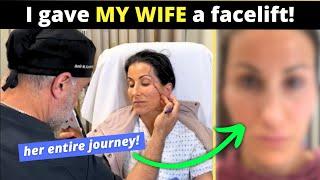 Plastic surgeon gives his wife a facelift!