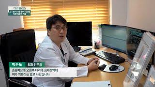 [JTBC 다큐플러스 인천나은병원 외과 박순도부장 자문인터뷰] 하지정맥류 원인과 진단